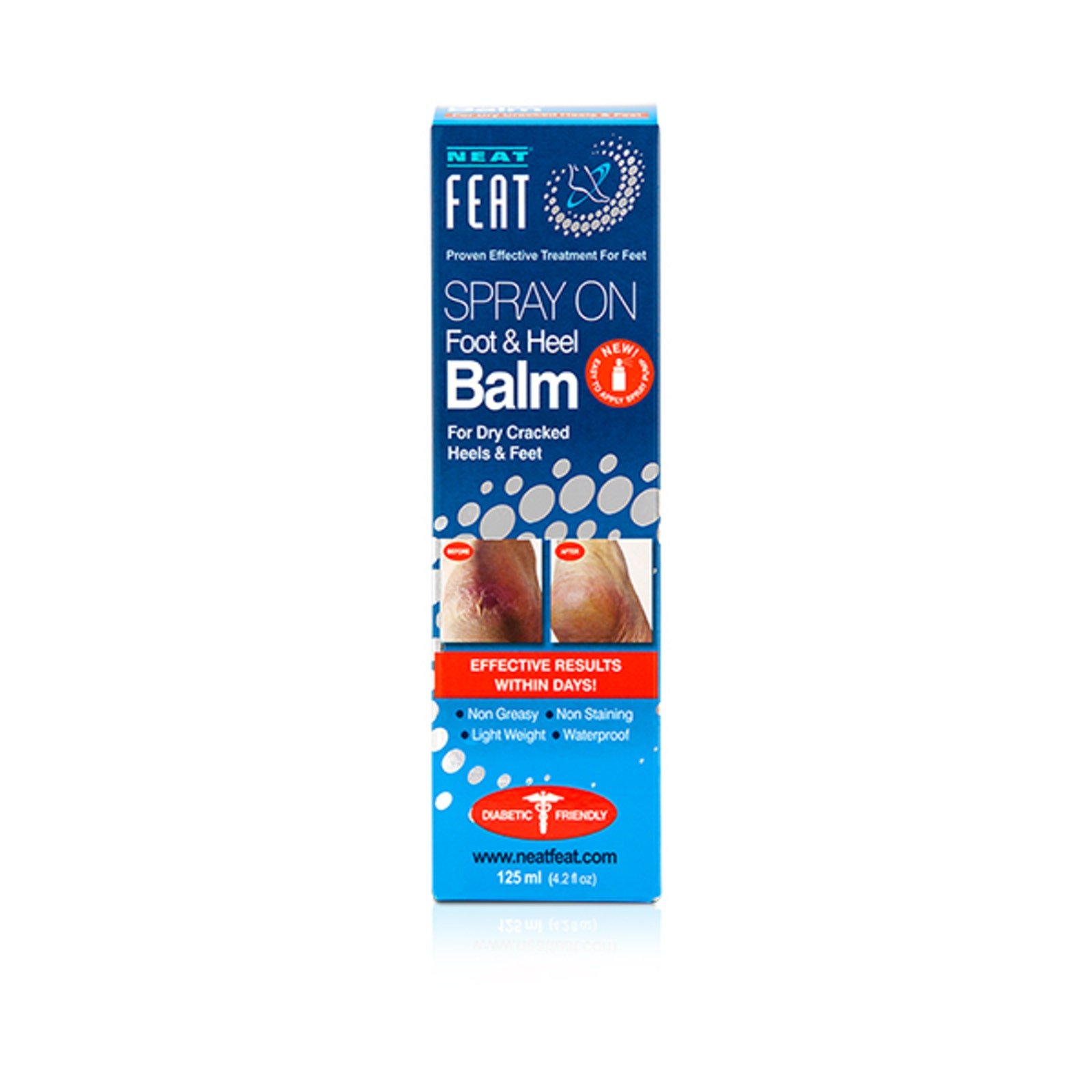 Neat Feat Balm for Feet & Talones Spray 125 ml | CMC Pharmacy Cabo Delivery in Cabo Neat Feat Balm for Feet & Talones Spray 125 ml